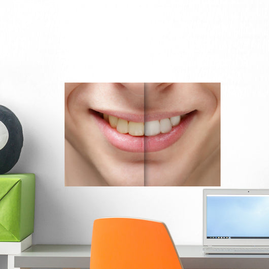young man smile before and after teeth whitening Wall Mural
