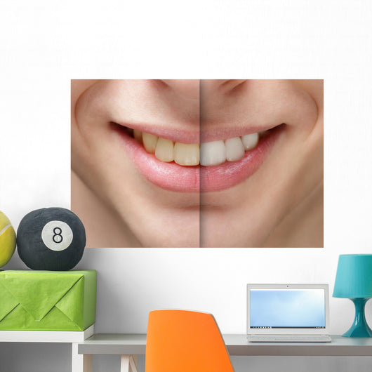 young man smile before and after teeth whitening Wall Mural