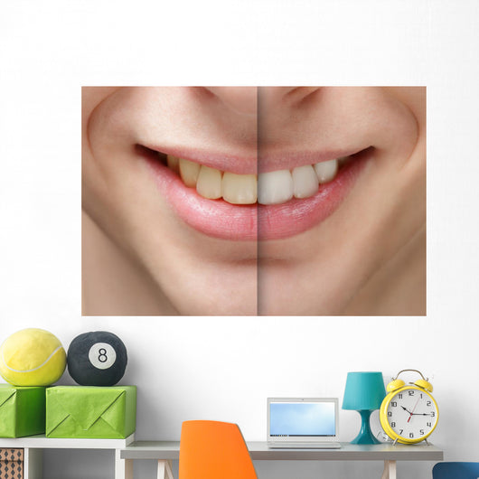young man smile before and after teeth whitening Wall Mural