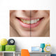 young man smile before and after teeth whitening Wall Mural