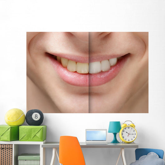young man smile before and after teeth whitening Wall Mural