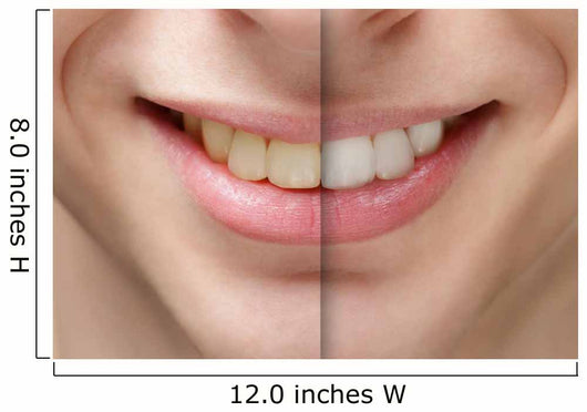 young man smile before and after teeth whitening Wall Mural
