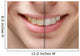 young man smile before and after teeth whitening Wall Mural