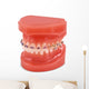 braces model Wall Decal