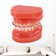 braces model Wall Decal