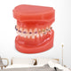 braces model Wall Decal