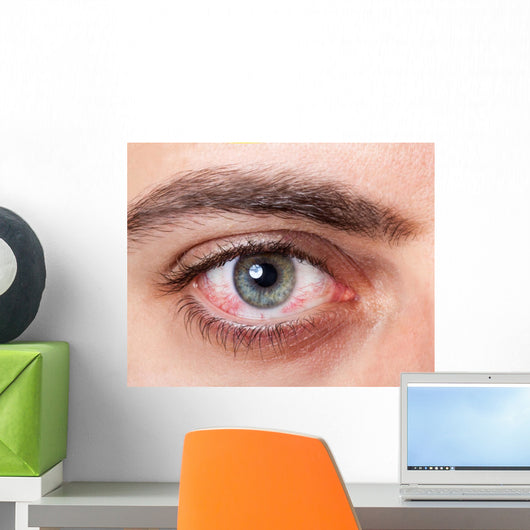 Irritated red bloodshot eye Wall Mural