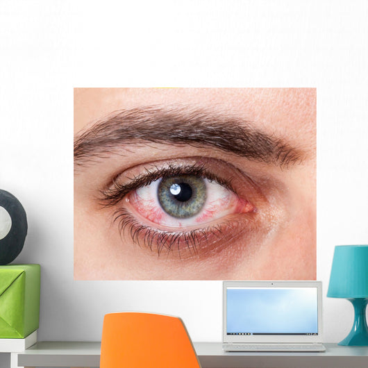 Irritated red bloodshot eye Wall Mural