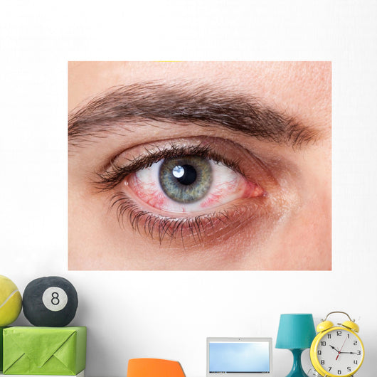 Irritated red bloodshot eye Wall Mural