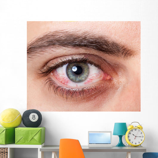 Irritated red bloodshot eye Wall Mural