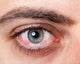 Irritated red bloodshot eye Wall Mural