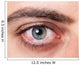 Irritated red bloodshot eye Wall Mural