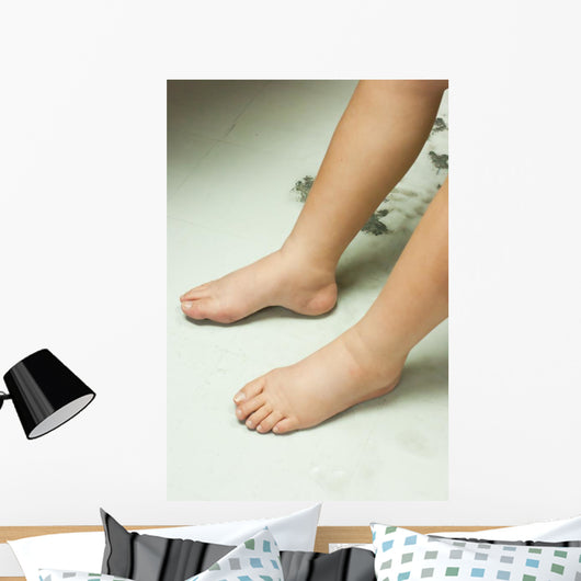 Gross edema of leg and foot Wall Mural
