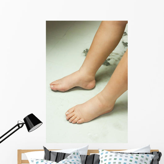 Gross edema of leg and foot Wall Mural