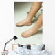 Gross edema of leg and foot Wall Mural