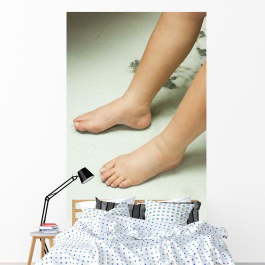 Gross edema of leg and foot Wall Mural