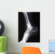 ankle xray Wall Mural