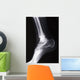 ankle xray Wall Mural