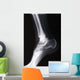 ankle xray Wall Mural