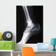 ankle xray Wall Mural
