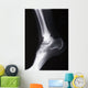 ankle xray Wall Mural