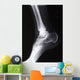 ankle xray Wall Mural