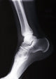 ankle xray Wall Mural