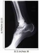 ankle xray Wall Mural