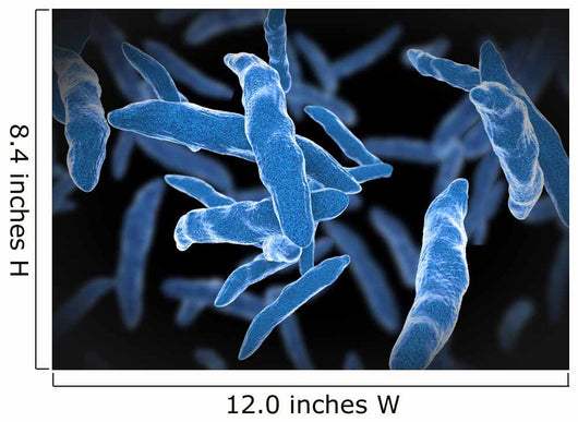 Bacterial infection tuberculosis Wall Mural