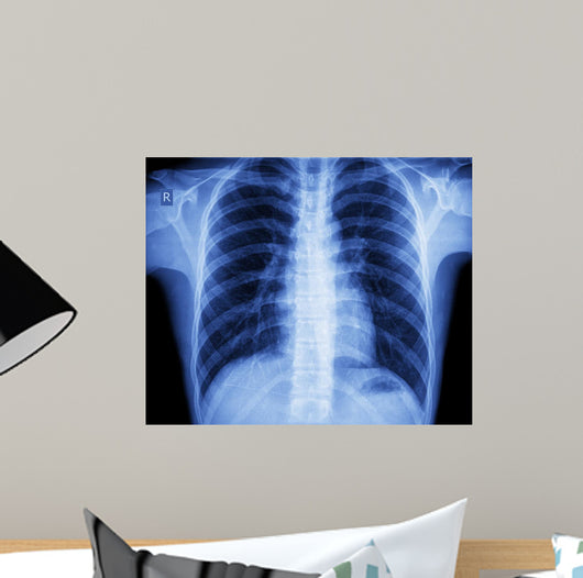 x-ray chest Wall Mural