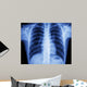 x-ray chest Wall Mural