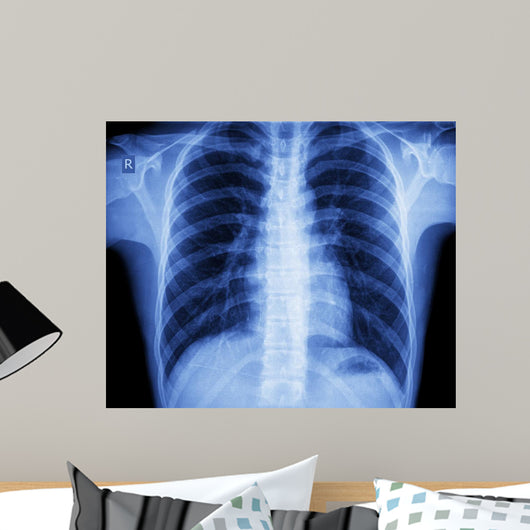 x-ray chest Wall Mural