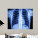 x-ray chest Wall Mural