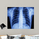 x-ray chest Wall Mural