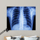 x-ray chest Wall Mural