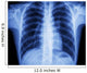 x-ray chest Wall Mural
