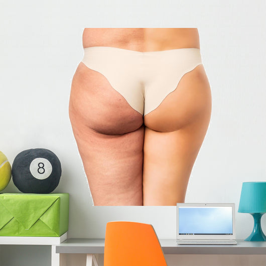 Cellulite treatment, before and after Wall Decal