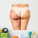 Cellulite treatment, before and after Wall Decal