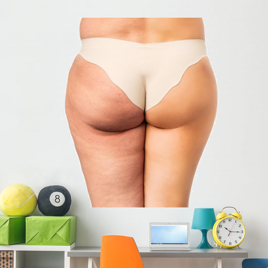 Cellulite treatment, before and after Wall Decal