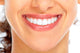 Beautiful woman smile Wall Mural