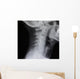 Human Spine X-ray Wall Decal