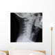 Human Spine X-ray Wall Decal