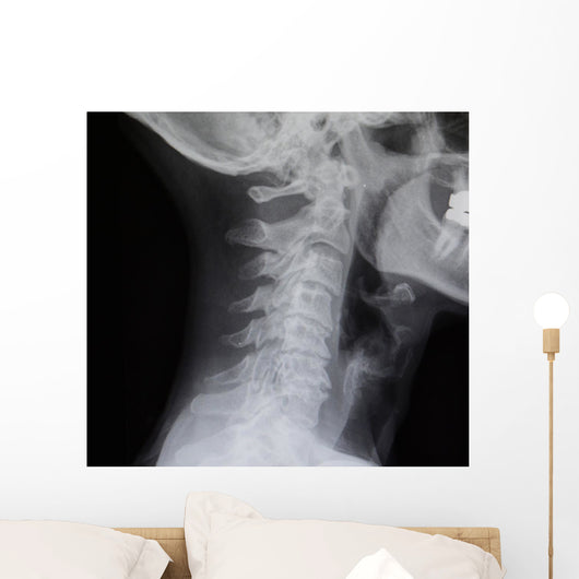 Human Spine X-ray Wall Decal