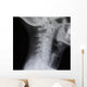 Human Spine X-ray Wall Decal