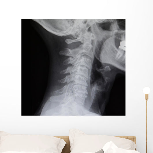Human Spine X-ray Wall Decal