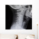 Human Spine X-ray Wall Decal