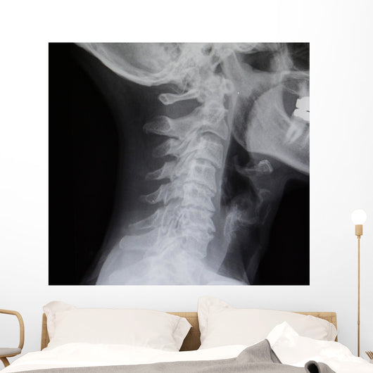 Human Spine X-ray Wall Decal