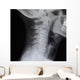 Human Spine X-ray Wall Decal