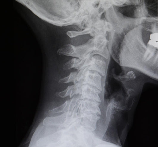 Human Spine X-ray Wall Decal