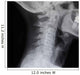 Human Spine X-ray Wall Decal